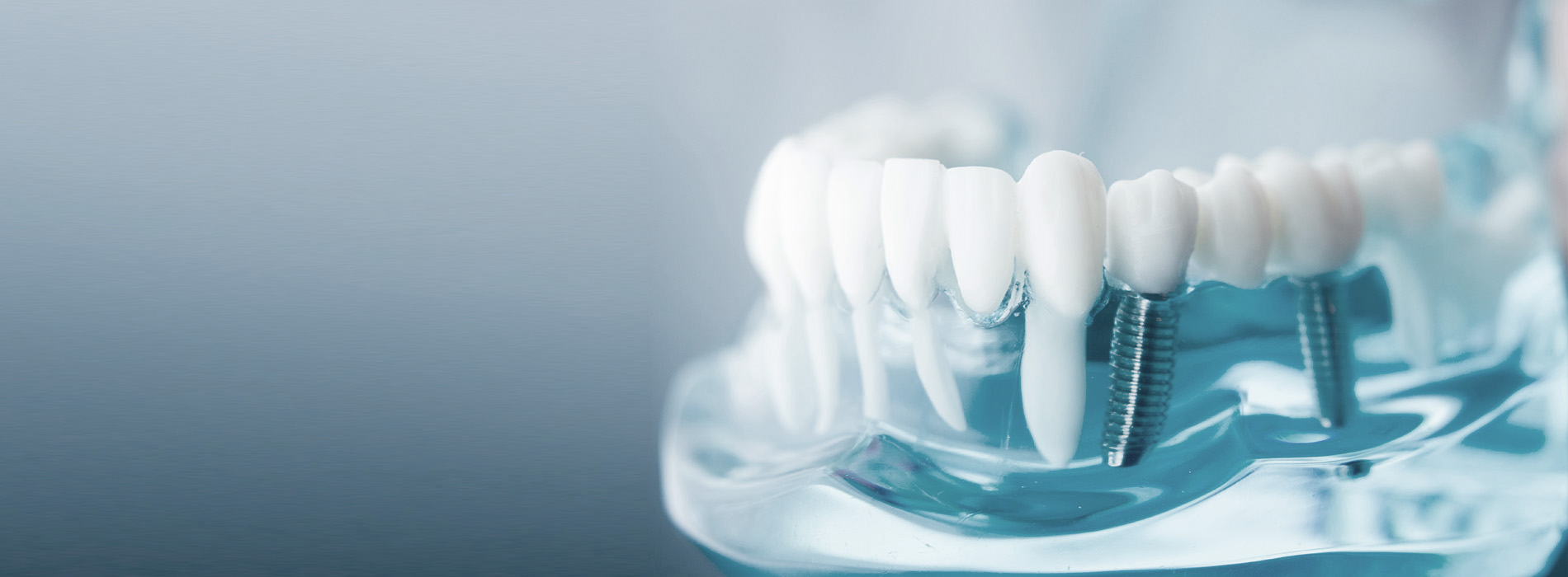 Periodontal Office in Norwood MA